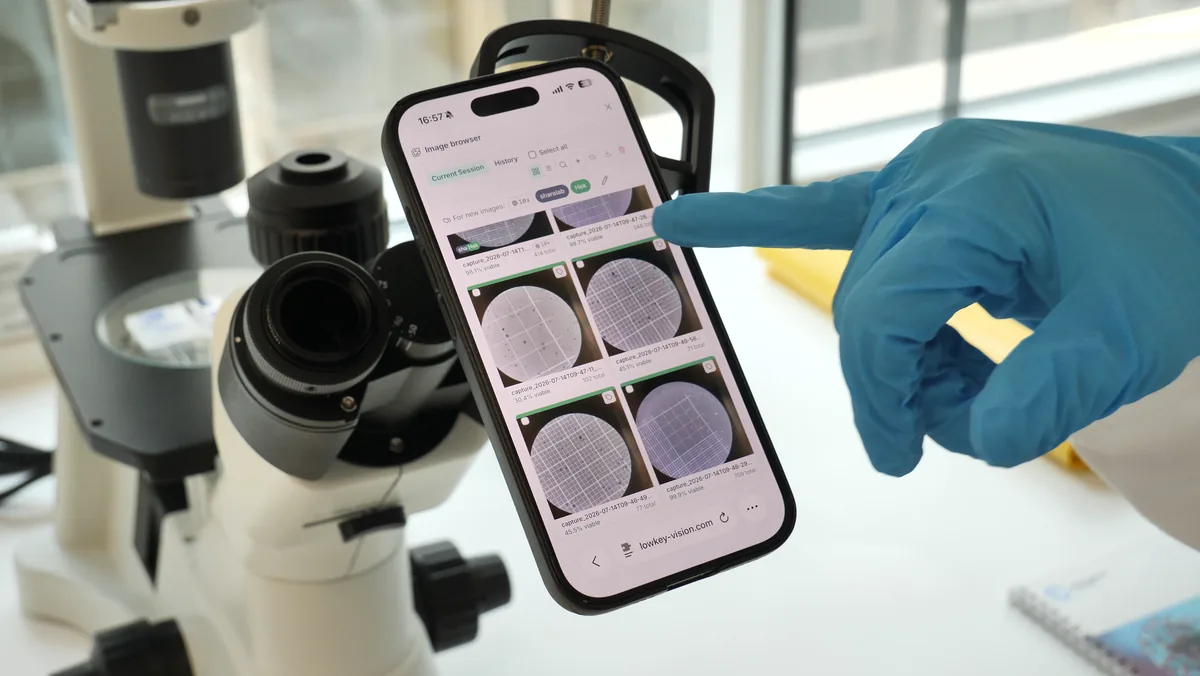 A gloved hand reviewing previous runs in the CellCount image gallery on a phone